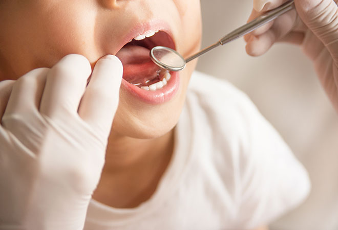 虫歯の検査と治療、ブラッシング指導