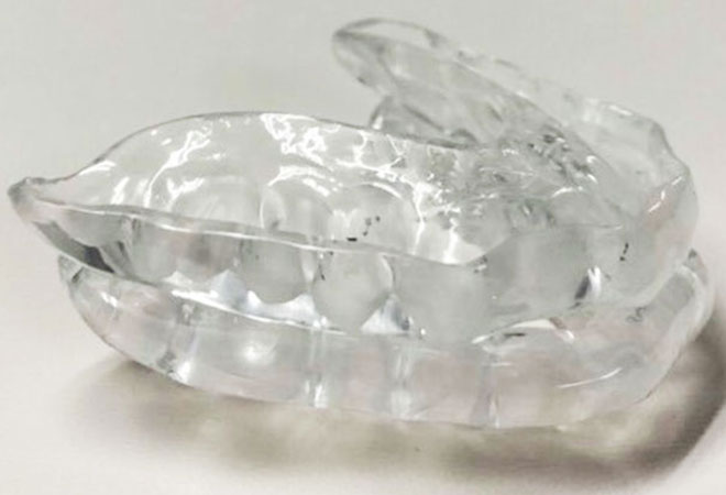 マウスピース療法